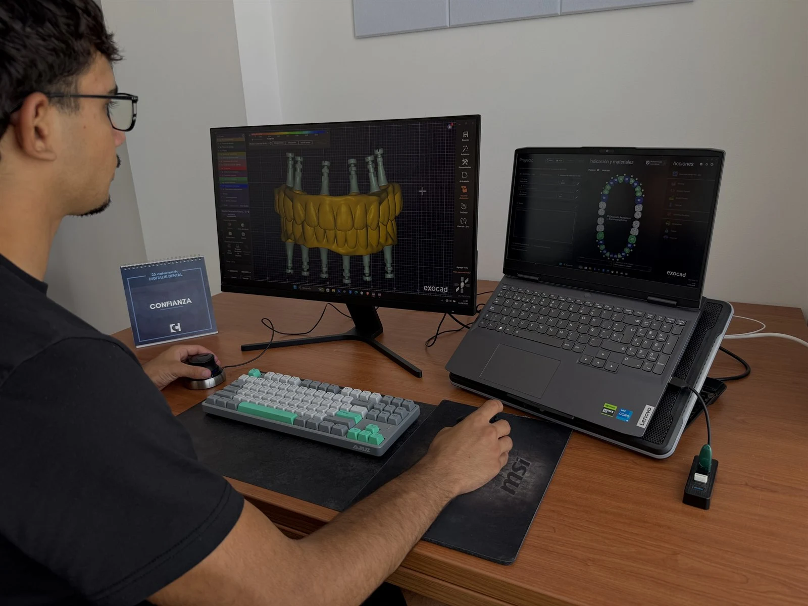 Sala de diseño CAD/CAM del laboratorio dental Digitalis en Málaga